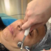آبرسانی پوست صورت فیشال جوانسازی پوست صورت|خدمات آرایشگری و زیبایی|شیراز, شهرک سراج‎|دیوار