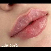 بمب تخفیف ژل و بوتاکس