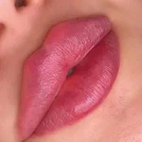 تزریق ژل و بوتاکس|خدمات آرایشگری و زیبایی|اصفهان, سنبلستان|دیوار