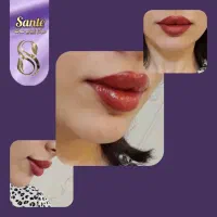 بوتاکس رایگان|خدمات آرایشگری و زیبایی|همدان, |دیوار