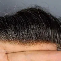 حراج و جشنواره بزرگ پروتز و ریموور و چسب مو|حراج|شیراز, بعثت|دیوار