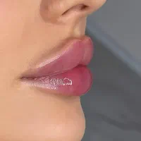 تزریق ژل و چربی، بوتاکس،هایفو|خدمات آرایشگری و زیبایی|مشهد, بهشت|دیوار