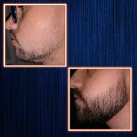 ۳۰بیل|آرایشی، بهداشتی، درمانی|نورآباد ممسنی, |دیوار