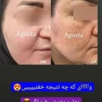 انواع سرم|آرایشی، بهداشتی، درمانی|شیراز, باجگاه|دیوار