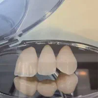 دندانسازی، وکس آپ، سنگ فریم