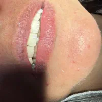 خدمات دندانپزشکی نازلترین قیمت