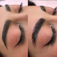 کاشت|خدمات زیبایی و سلامت|دورود, |دیوار