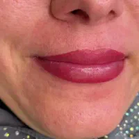 خدمات حرفه ای شیدینگ لب و رفع تخصصی تیرگی لب