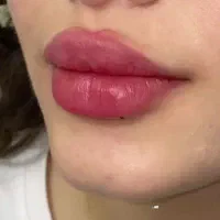 ژل.بوتاکس.آنزیم .جوانساز. لاغری امپول اسپارتینا