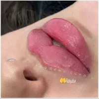 ژل بوتاکس|خدمات آرایشگری و زیبایی|قم, بکایی|دیوار