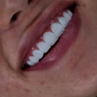 دندانپزشکی اقساطی بدون بهره|خدمات آرایشگری و زیبایی|کرج, کوی کارمندان شمالی|دیوار