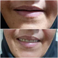 ساخت دندان و دندان سازی قدیری|خدمات آرایشگری و زیبایی|یزد, |دیوار