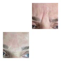 آموزش تزریق ژل لب.ژل گونه بوتاکس انواع مزوتراپی|خدمات آموزشی|آبادان, |دیوار