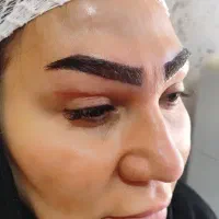 شرایط ویژه کاشت ابرو و‌مو‌ و ریش