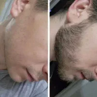 ریشات مثل جنگل میشه