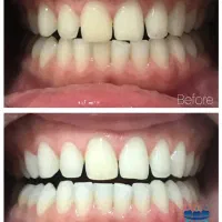 کلینیک تخصصی دندانپزشکی سیب (نرخ خدمات نیمه دولتی)|خدمات آرایشگری و زیبایی|تبریز, |دیوار