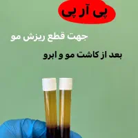 پی آر پی مو و صورت تخفیف ویژه پی ارپی بعدازکاشت مو|خدمات آرایشگری و زیبایی|قزوین, |دیوار