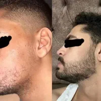بوکس کار کن،ریشت فولادی شه