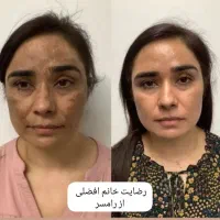 زیبایی پوستت رو به ما بسپر|آرایشی، بهداشتی، درمانی|تهران, سلسبیل شمالی|دیوار