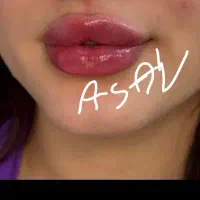 مدل فیلر لب وفول فیس برندهای تک سی سی به مدت ۳روز|خدمات آرایشگری و زیبایی|یاسوج, |دیوار