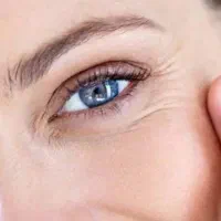 خدمات لیزر موهای زاید بوتاکس فیلر.ژل..