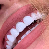 دندانپزشکی و زیبایی بدون پیش پرداخت|خدمات آرایشگری و زیبایی|قم, نوقطار|دیوار