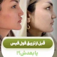 خدمات ژل و بوتاکس|خدمات آرایشگری و زیبایی|مشهد, سجاد شهر|دیوار