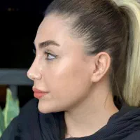 عمل بینی با شرایط ویژه(ماهانه ۱۰تومن)|خدمات آرایشگری و زیبایی|مهاباد (آذربایجان غربی), |دیوار