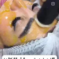 فیشیال تخصصی و درمانی ویژه بانوان