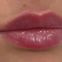 خدمات ژل بوتاکس مزو فیلر انزیم بوتاکس|خدمات آرایشگری و زیبایی|تهران, تهرانسر مرکزی|دیوار