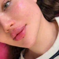 آموزش تزریق ژل و بوتاکس|خدمات آرایشگری و زیبایی|یاسوج, |دیوار