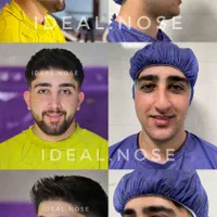 جشنواره تابستانه جراحی زیبایی بینی