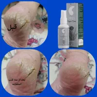 تونیک نانو نقره|آرایشی، بهداشتی، درمانی|کاشمر, |دیوار