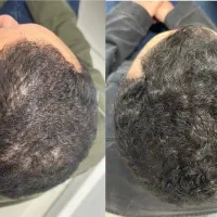بزنی پر میشه