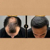 فقط یکبار این مایع بزن و معجزه اش‌و ببین