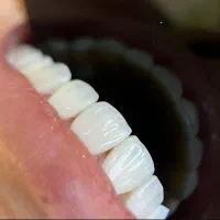 جشنواره کلیه خدمات دندانپزشکی با اقساط ۱۵ ماهه|خدمات آرایشگری و زیبایی|تبریز, |دیوار