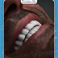 دندانپزشکی اطلس