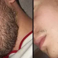 واسه پرپشت شدنش اقدام کن