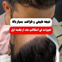 میکرواسکالپ فی اسکالپ سر|خدمات آرایشگری و زیبایی|شیراز, ملاصدرا|دیوار