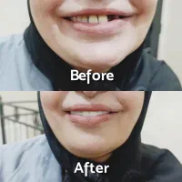 لمینت متحرک