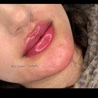 فیلر اقتصادی بوتاکس پیرسینگ|خدمات آرایشگری و زیبایی|ایرانشهر, |دیوار