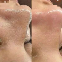 جشنواره و آفر ویژه آموزش و فیشیال پاکسازی گلستان|خدمات آرایشگری و زیبایی|گلستان (تهران), |دیوار