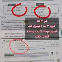 بهبود کبد چرب|خدمات آرایشگری و زیبایی|درگهان, |دیوار