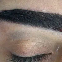 کاشت ابرو شقیقه و مو|خدمات زیبایی و سلامت|تبریز, |دیوار