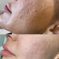 خدمات زیبایی|خدمات زیبایی و سلامت|مشهد, هفت تیر (حافظ)|دیوار