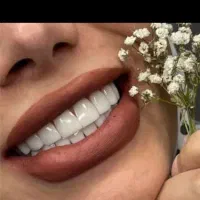 ایمپلنت دندان فقط از 6900 قسطی 6 تا 24 ماه|خدمات آرایشگری و زیبایی|تهران, میرداماد|دیوار