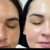 کرم چهل گیاه معجزه|آرایشی، بهداشتی، درمانی|شیراز, انجیر|دیوار