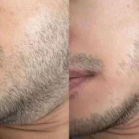 آخرین روشیه که امتحان میکنی