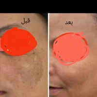مشاوره وهمکاری|فعالیت داوطلبانه|مشهد, شهید فرامرز عباسی|دیوار