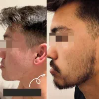 رشد مو VIP|آرایشی، بهداشتی، درمانی|تهران, طرشت|دیوار